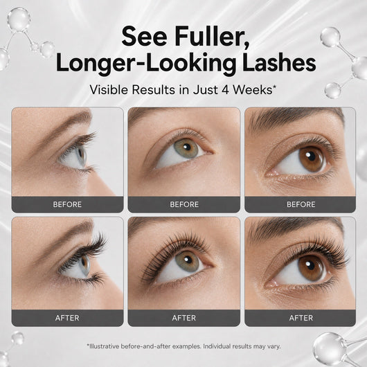 See fuller, longer-looking lashes — visible results in just 4 weeks (illustrative before and after)